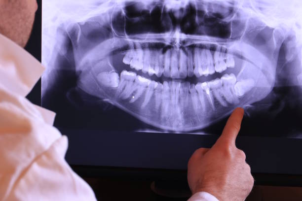 Best Emergency Care for Gum Disease in Taylor, TX